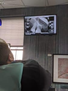 dental office hardware - x-rays shown on tv